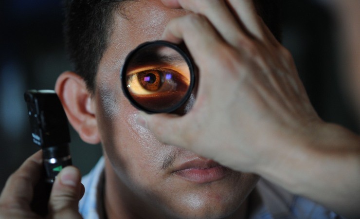 ectropion e blefarocalasi, cause della secchezza oculare