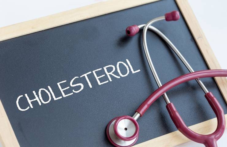 colesterolo alto sintomi occhi