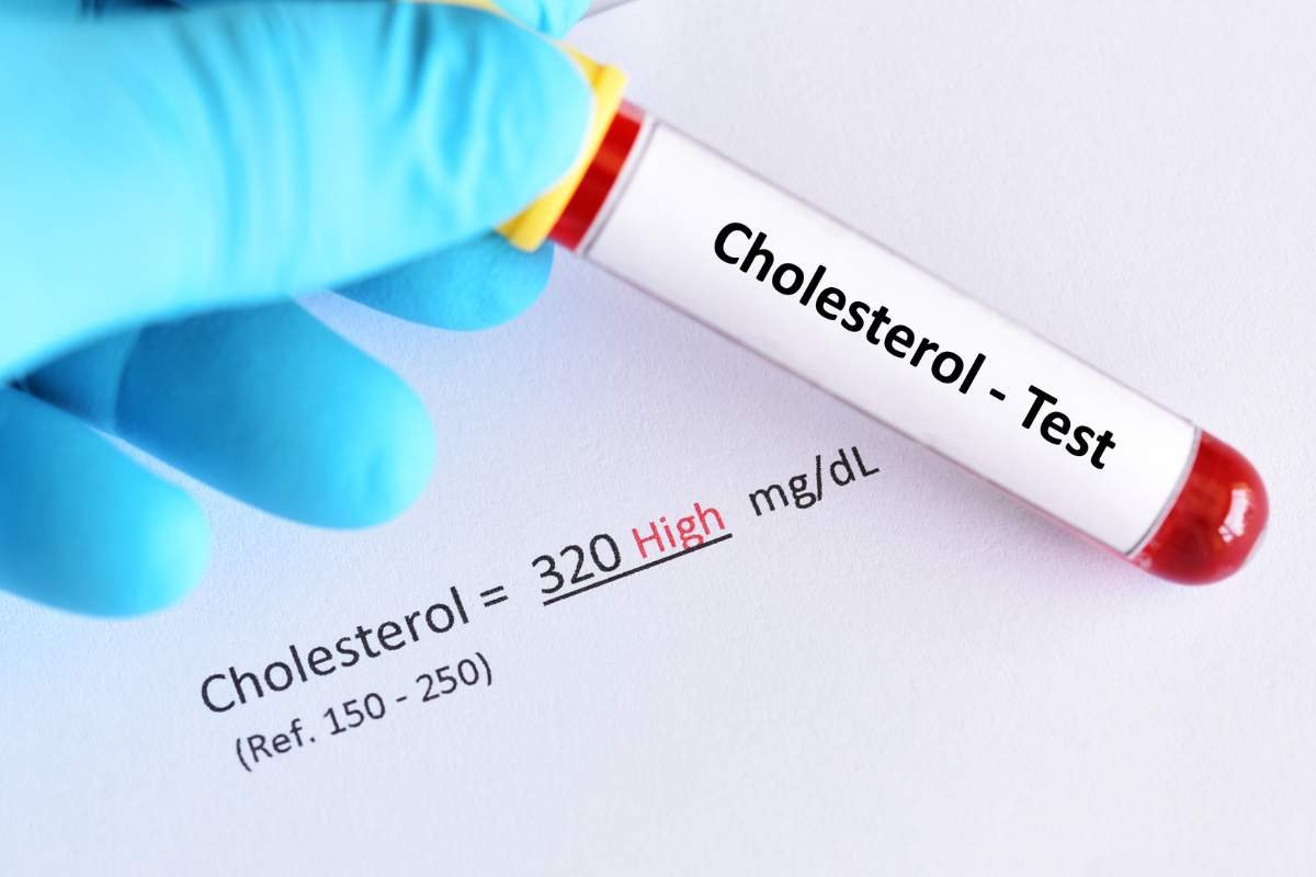 I sintomi precoci di colesterolo alto