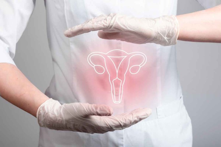 Endometriosi, cause e conseguenze