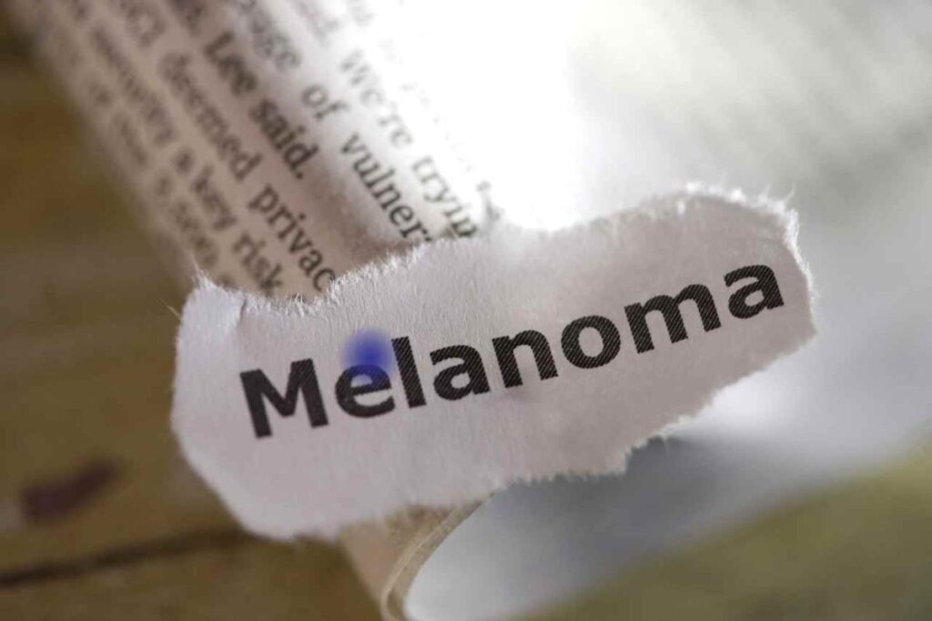 nei blu rischio melanoma