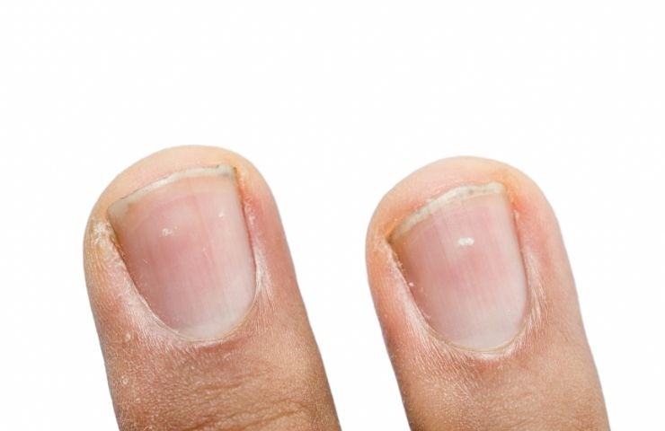 Le unghie delle mani e dei piedi possono comunicarci patologie e disturbi